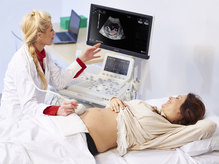 Preizkus Esaote ultrazvočnega aparata v praksi